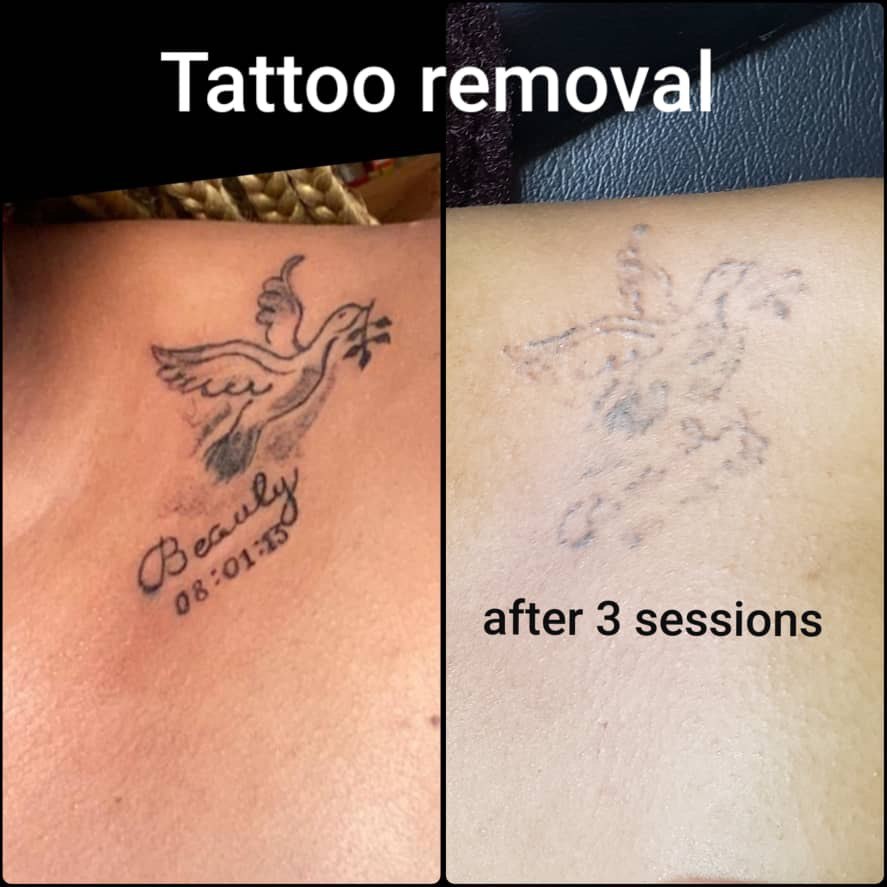 picture of tattoo
